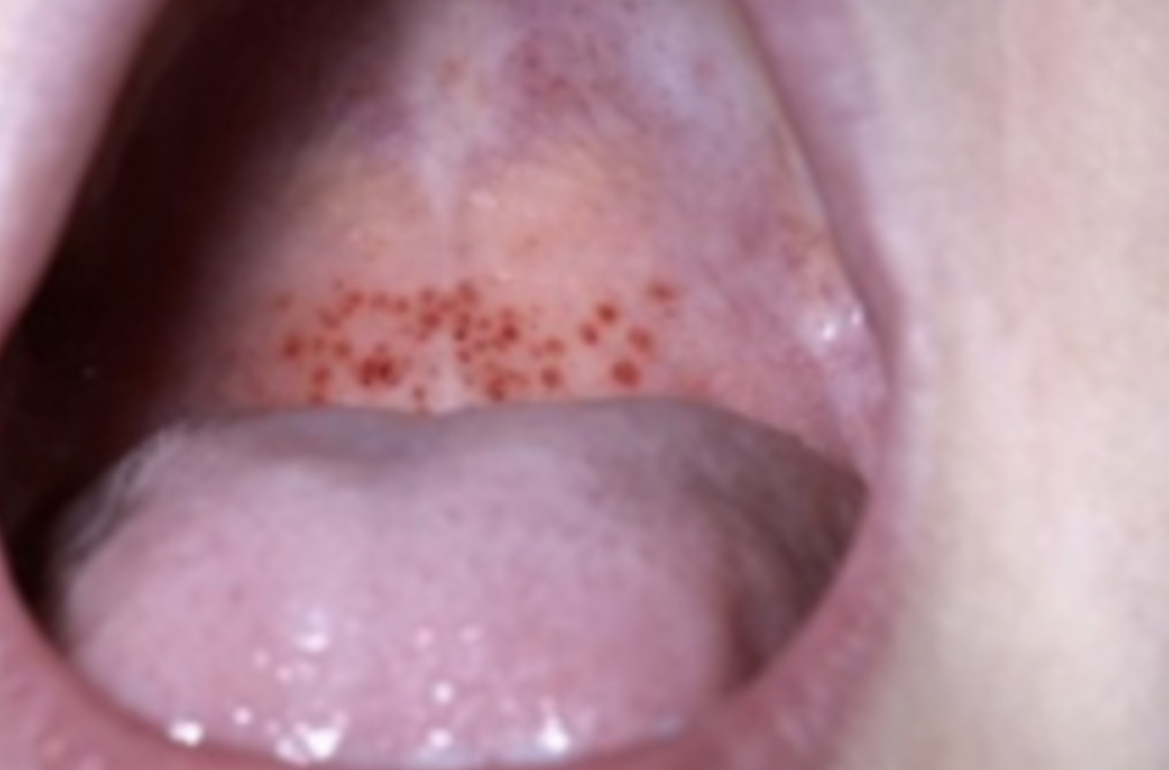 Di kham vi dau hong,  chang trai tre phat hien ung thu mau anh 1