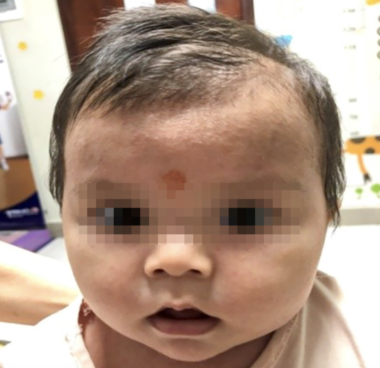 Can trong khi tre bi rom say anh 1