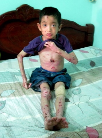 Noi dau cua nhung than phan mac benh 'gioi day' hinh anh