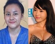 Guong mat hot girl Viet sung phu sau nghi an dao keo hinh anh