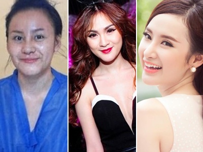 Nhung hot girl Viet dan dau ve so lan phau thuat tham my hinh anh