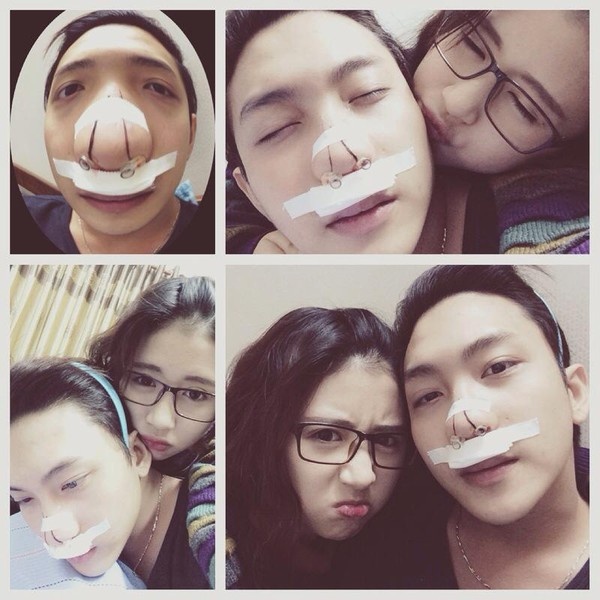 Hot boy Bê Trần cũng từng có một thời gian phải vào viện để phẫu thuật mũi (không phải phẫu thuật thẩm mỹ mà là một tiểu phẫu nhỏ vì cứ đến mùa đông là anh chàng gặp khó khăn về hít thở). Tuy khá khó chịu vì phải lắp máy vào mũi nhưng Bê Trần vẫn tỏ ra lạc quan, vui vẻ và 