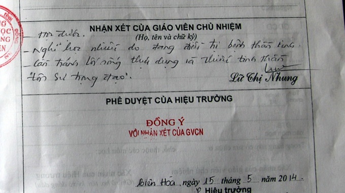 Dau nua dau, co giao phe bi benh than kinh hinh anh
