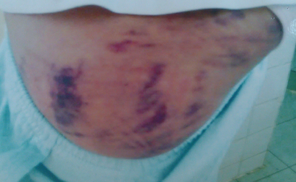 Thieu nu 18 tuoi bi cha me nhot, danh vi yeu thay hinh anh