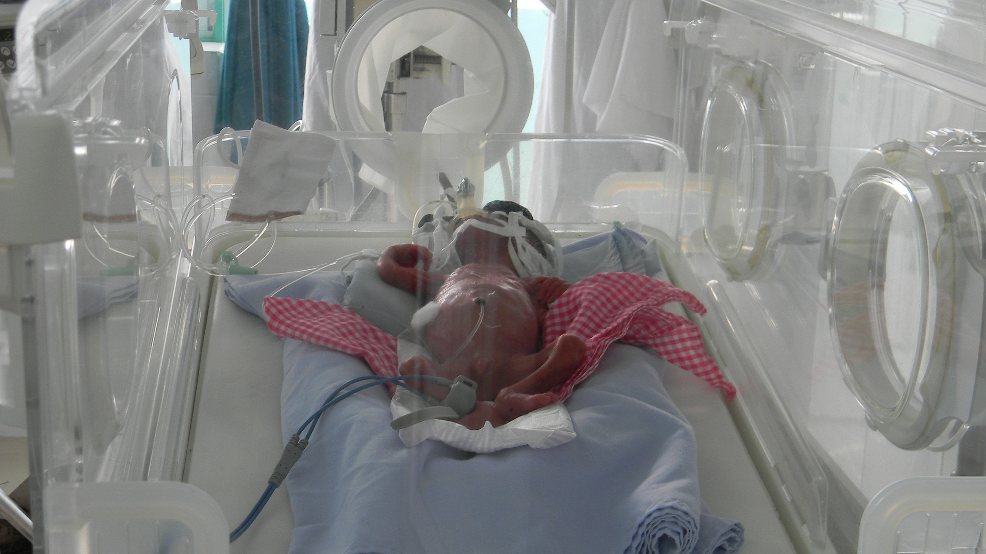 Em be so sinh suyt bi chon song da qua doi hinh anh