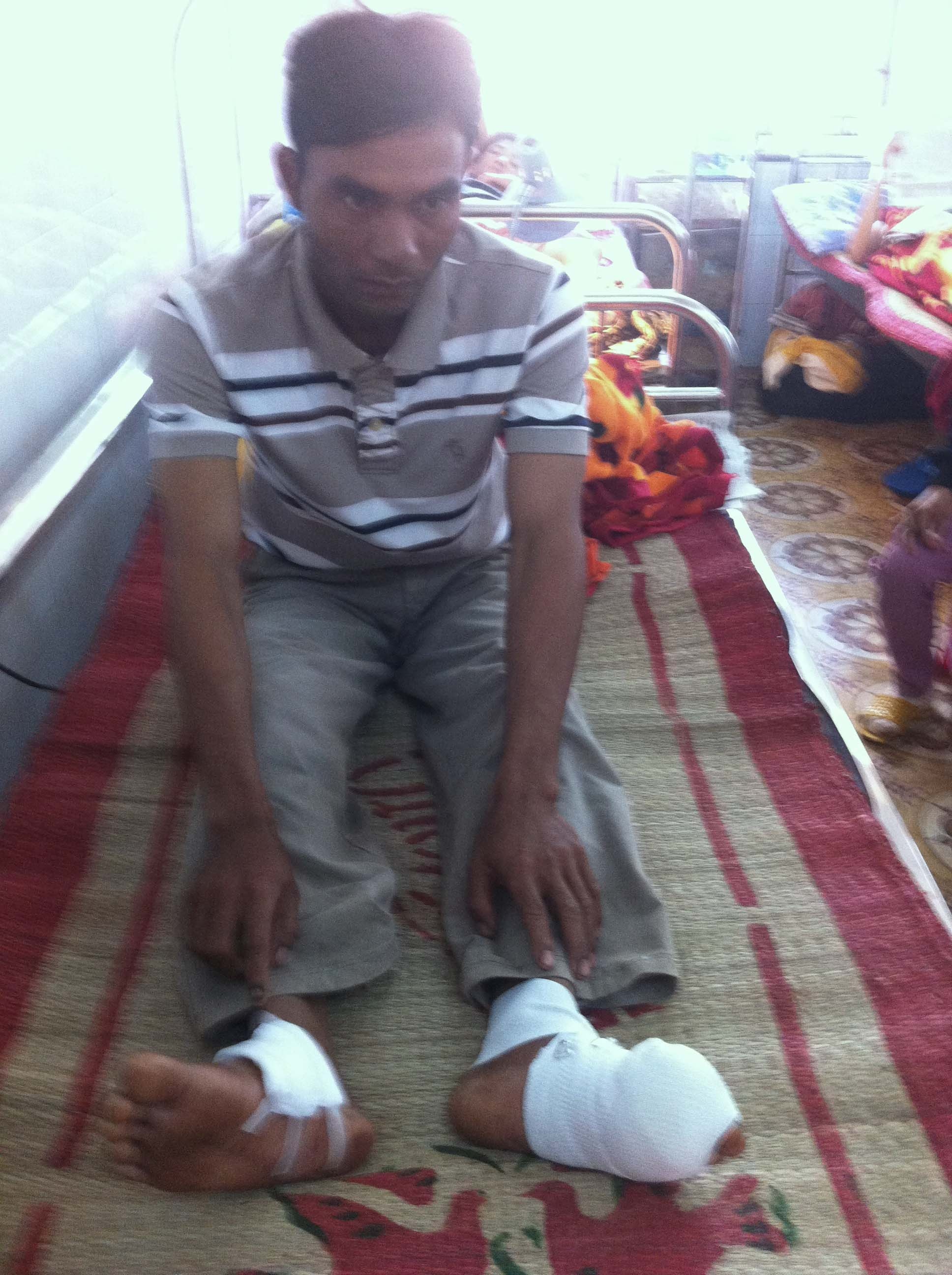 Bat doi pho kiem lam ban 2 phat dan vao chan nguoi dan hinh anh