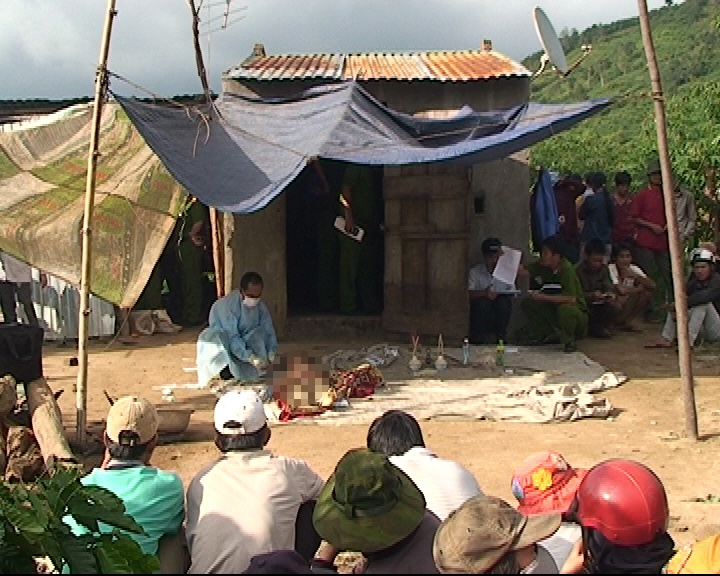 2 tre bi ke ac chem bang riu tu vong tai cho hinh anh