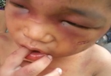 Clip be 3 tuoi bi cham tan thuoc, danh bam mat hinh anh