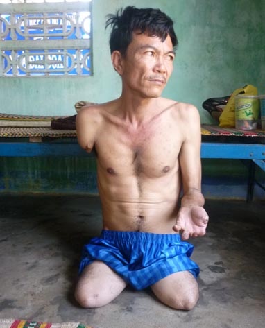 Nguoi dan ong bi rung dan chan tay o Khanh Hoa hinh anh