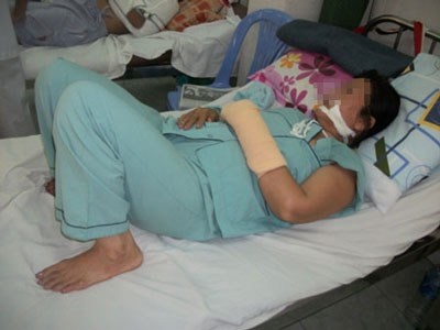 Nguoi phu nu chem dut tay tinh dich hinh anh