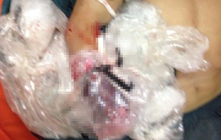 Dut lia canh tay khi dang danh ca tren bien hinh anh