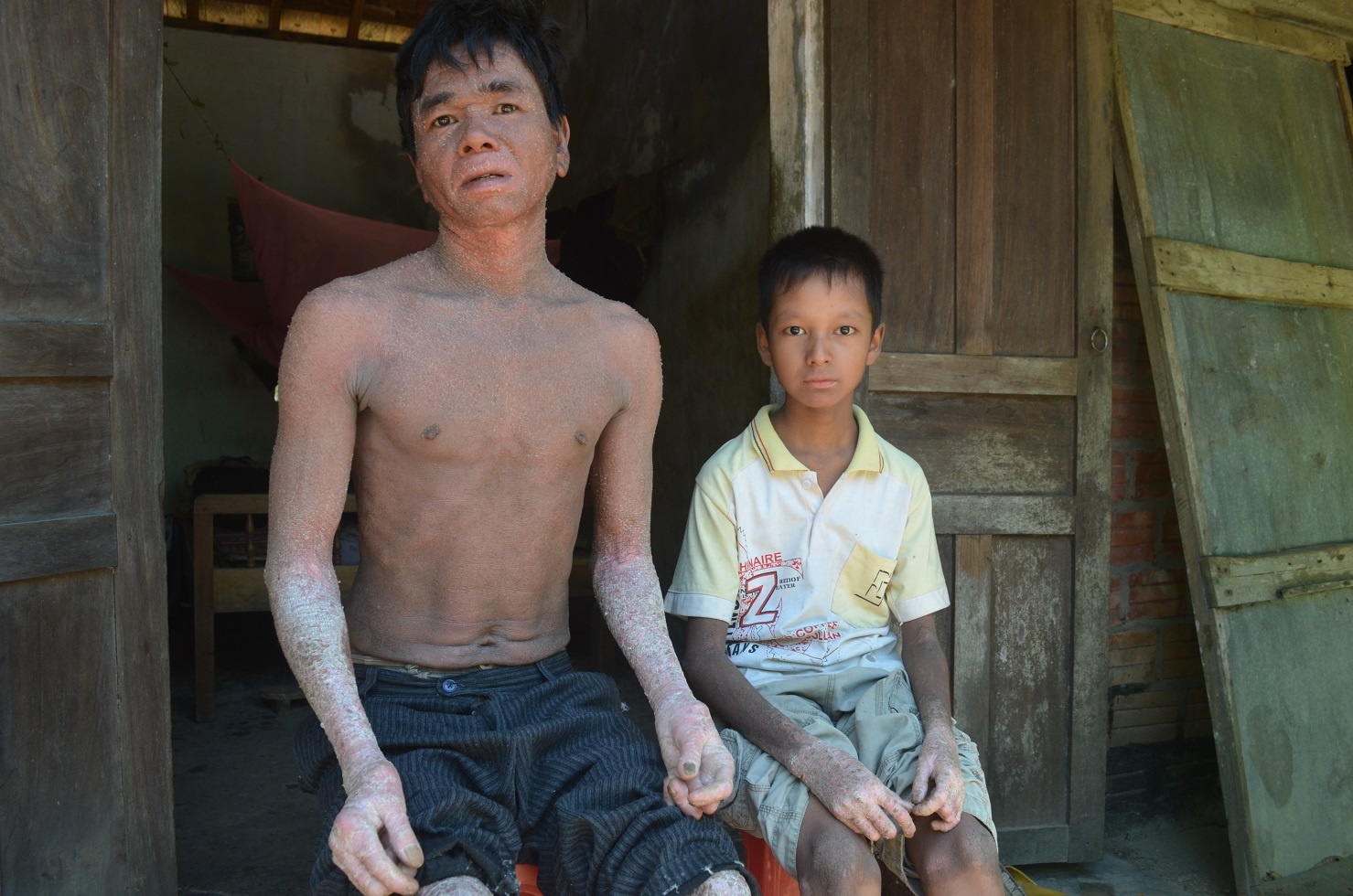 Hai cha con 'nguoi ran' o Quang Nam hinh anh