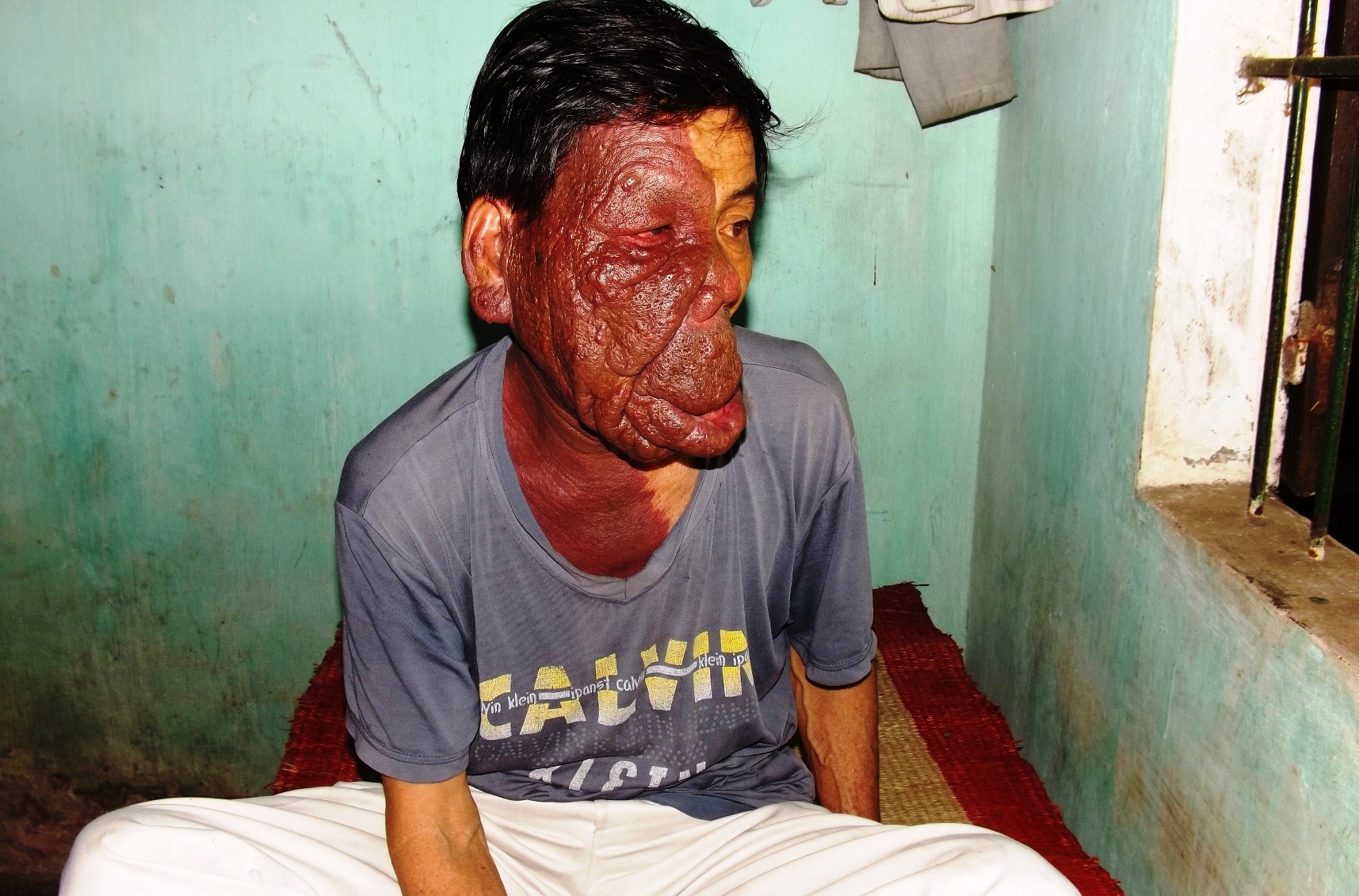 Nguoi co guong mat quai di lay tay che mat ban ve so hinh anh