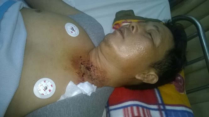 Ngoi trong nha bi da vang trung nguoi, rach phoi hinh anh