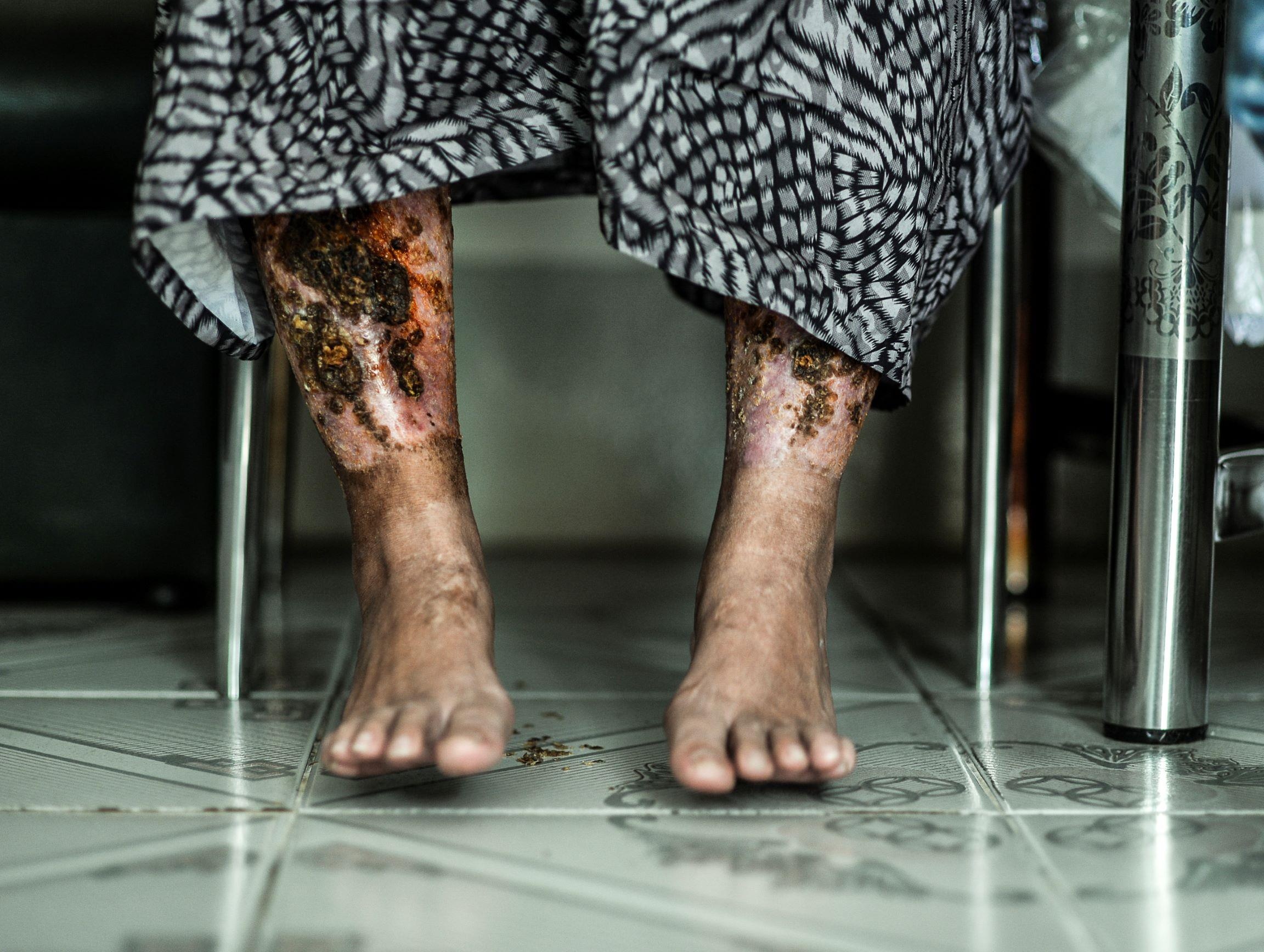 nan nhan vu tat axit anh 3