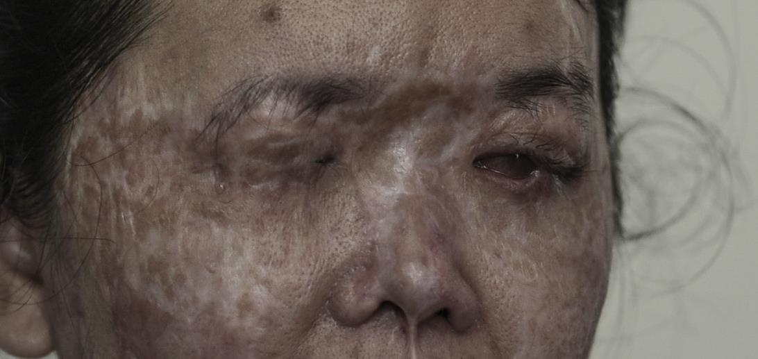 nan nhan vu tat axit anh 5