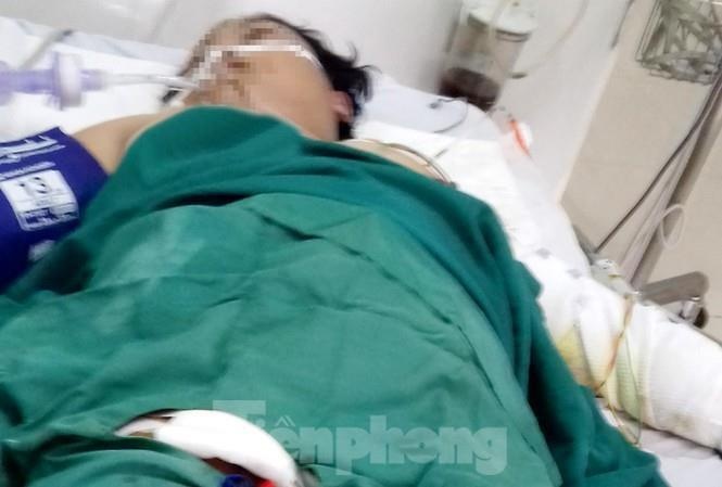 tuoi xang dot thai phu anh 1