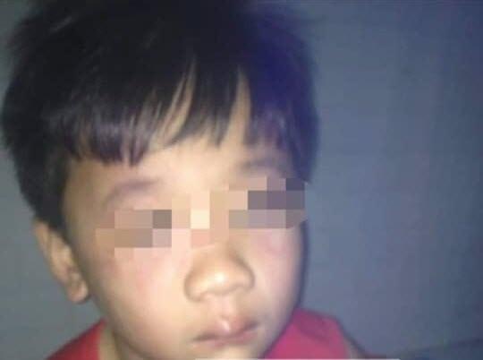 bao hanh tre em anh 1