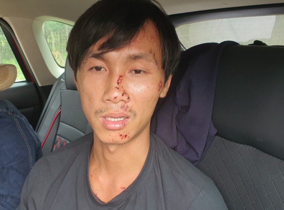 vụ tông xe khiến 8 người chết ở Bình Thuận ảnh 5 vu tong xe khien 8 nguoi chet o Binh Thuan anh 5