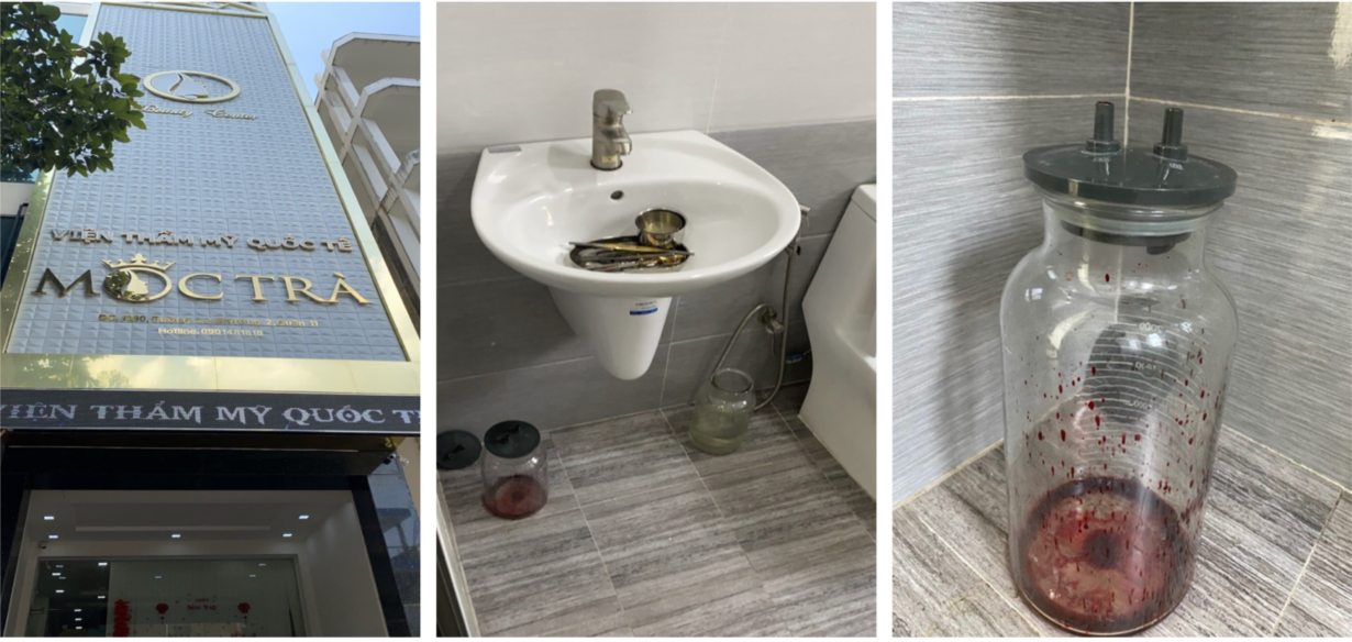 phau thuat tham my trai phep anh 1