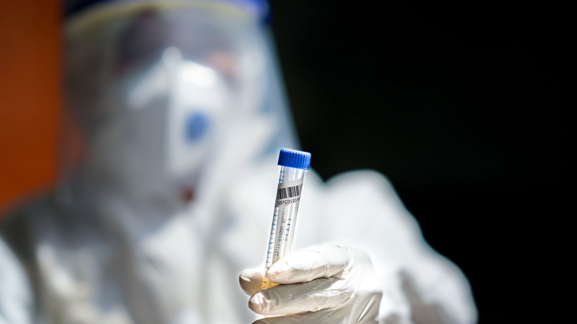 TP.HCM lay hon nua trieu mau xet nghiem nhanh trong 2 ngay hinh anh