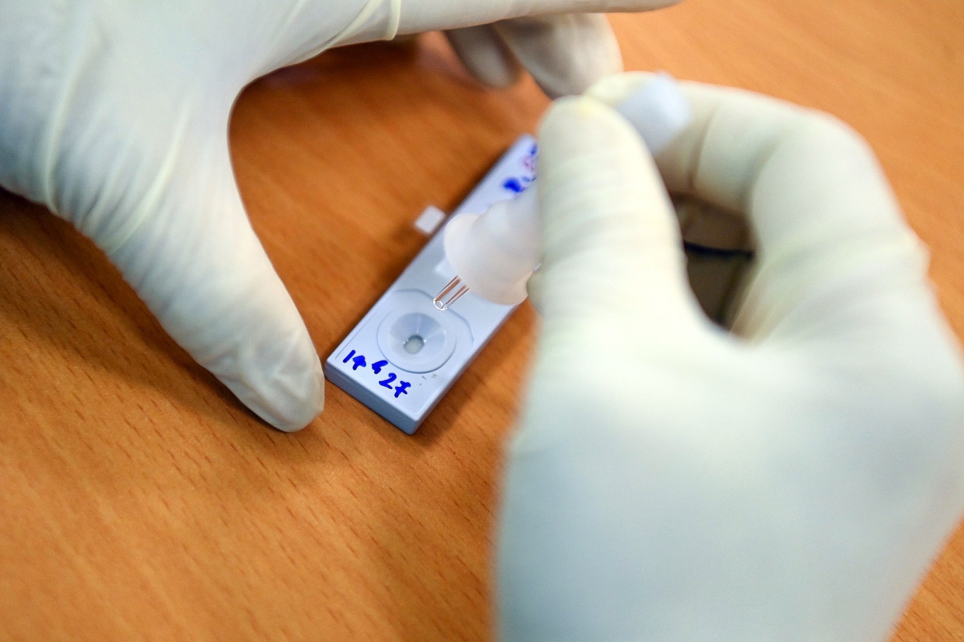 xet nghiem dien rong tai TP.HCM anh 2