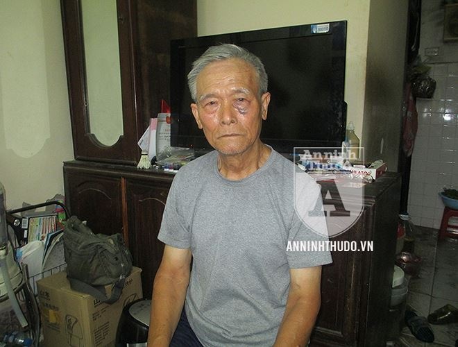 Cuop tien cua xe om anh 6