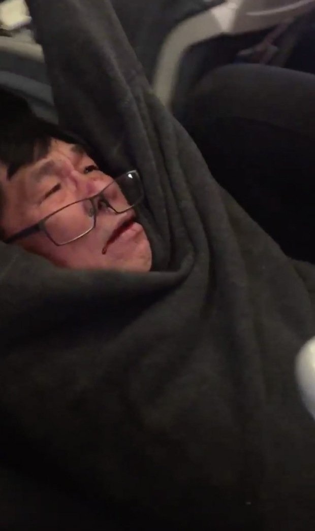 Bác sĩ bị lôi khỏi máy bay có thể thành triệu phú ảnh 1 Bac si bi loi khoi may bay co the thanh trieu phu anh 1