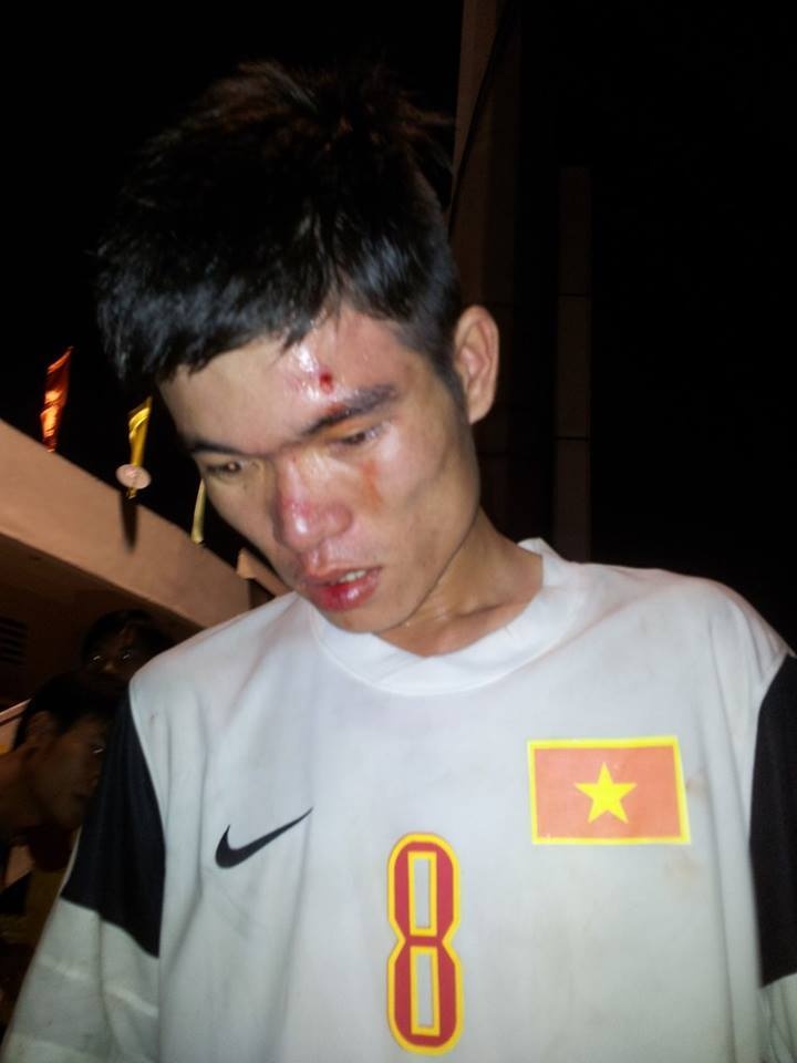 Mot fan xu Nghe bi danh bam dap tai BTV Cup hinh anh