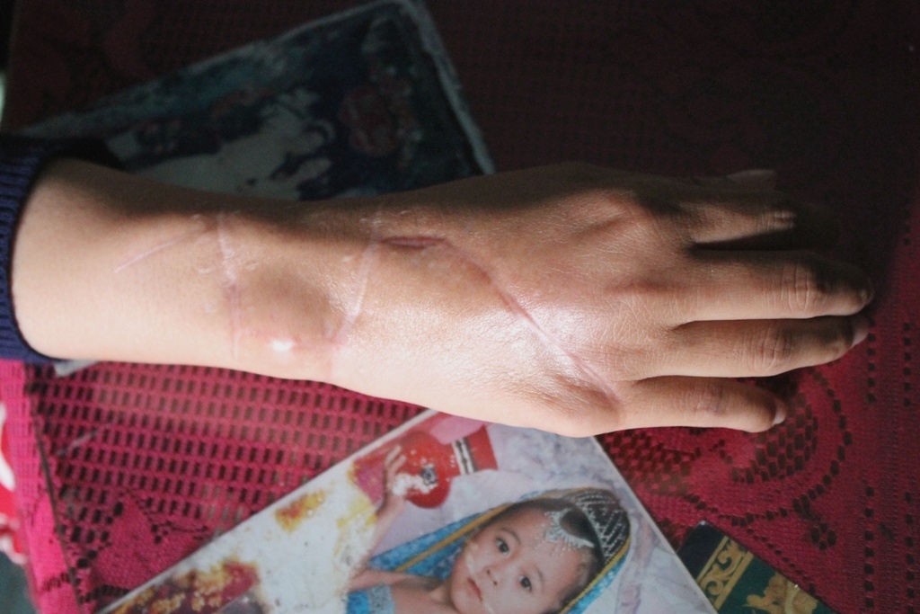 Co gai bi giang ho chat tay cuop xe SH bay gio ra sao? hinh anh