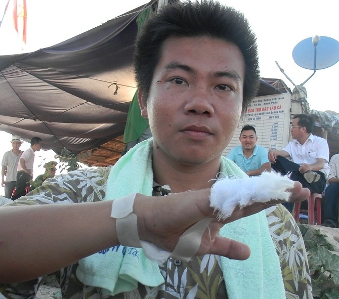 Phut can ke cai chet cua 10 ngu dan Da Nang hinh anh