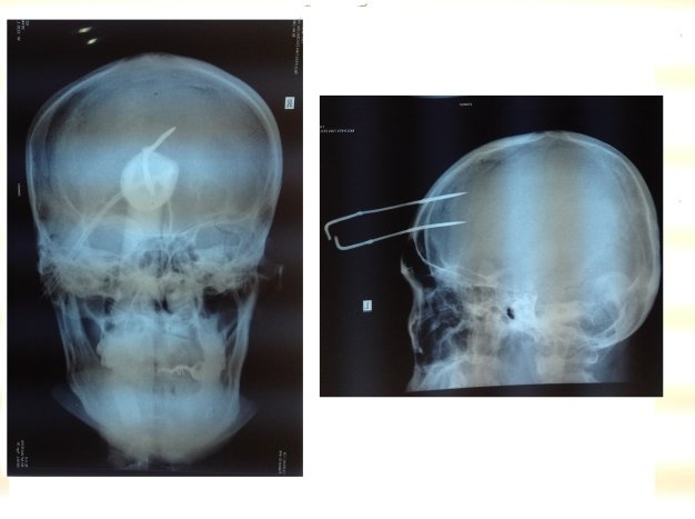 Hình ảnh bệnh viện đa khoa tỉnh Tây Ninh cung cấp.