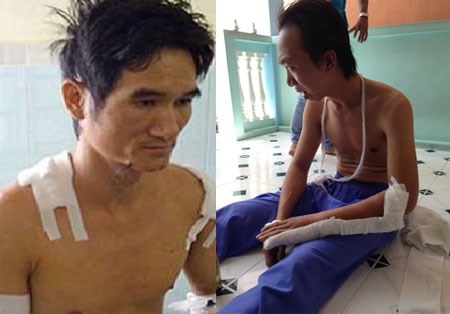Truy bat bang nhom giang ho 'so ma' chem cong an hinh anh