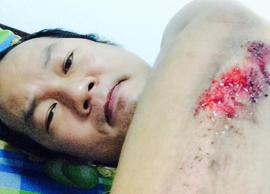 Dien vien hai Long 'dep trai' bi cuop giua dem khuya hinh anh