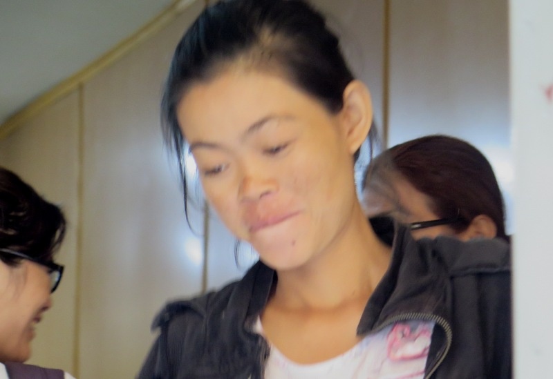 Giam an cho nguoi vo chem chong bi thuong hinh anh