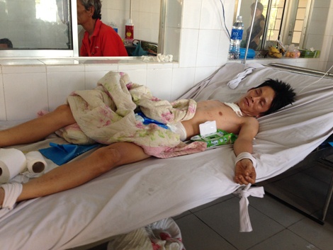Toi ac nup duoi vo boc tinh yeu hinh anh