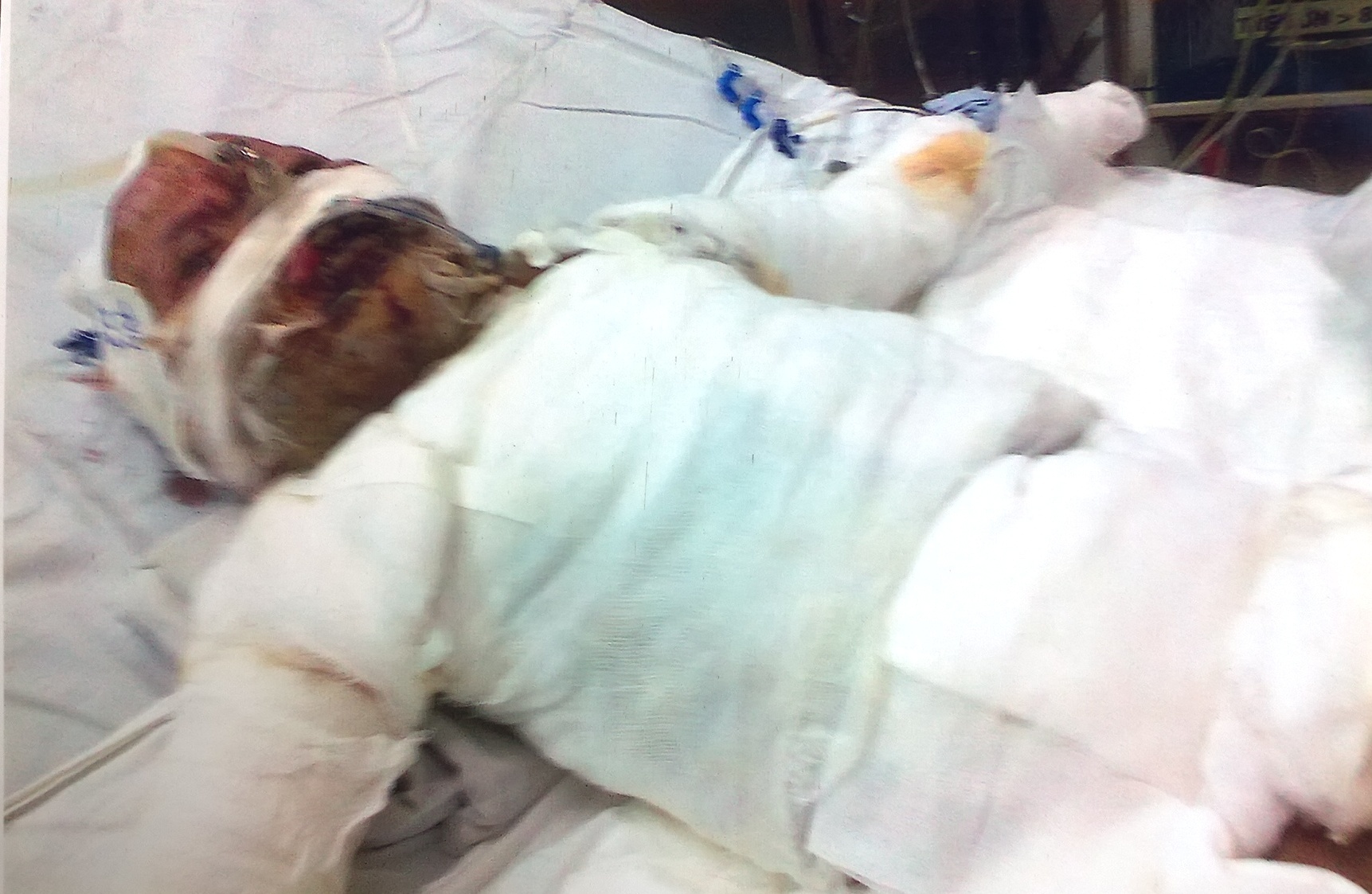 Be gai 5 tuoi bong toan than do than vang vao nguoi hinh anh