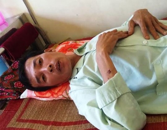 Mot nguoi dan bi pho cong an xa danh gay 4 xuong suon hinh anh