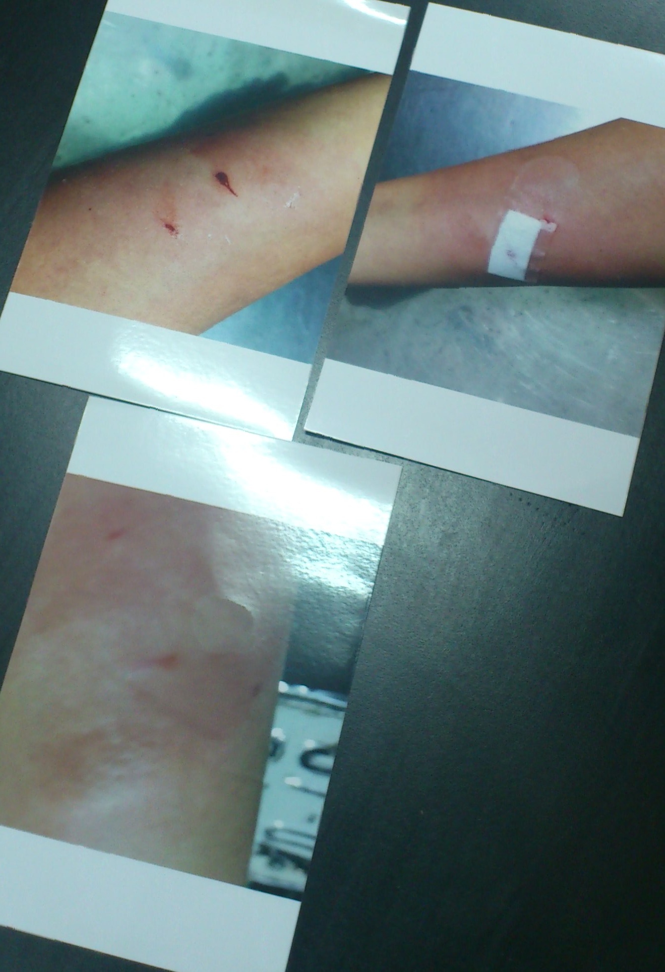 Giao vien to bi hoc sinh hanh hung tren buc giang hinh anh