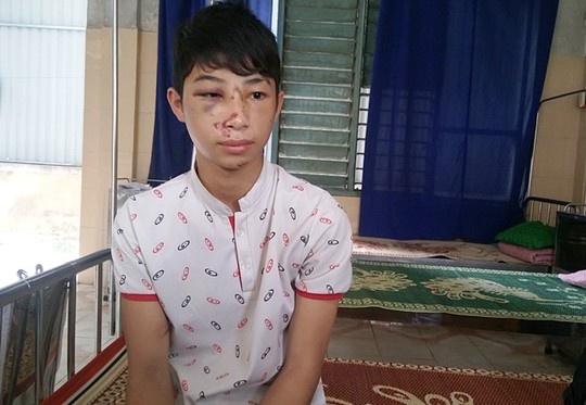 Phú bị đánh hội đồng dẫn đến thương tích.