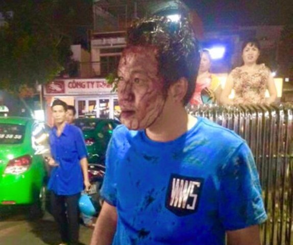 Cu cai khi gui xe, khach bi bao ve sieu thi danh guc hinh anh