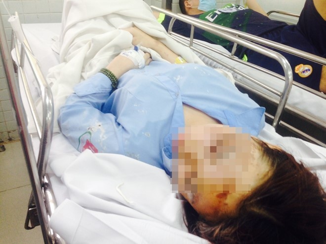 Tat axit rat tan doc nhung kho xu toi Giet nguoi hinh anh