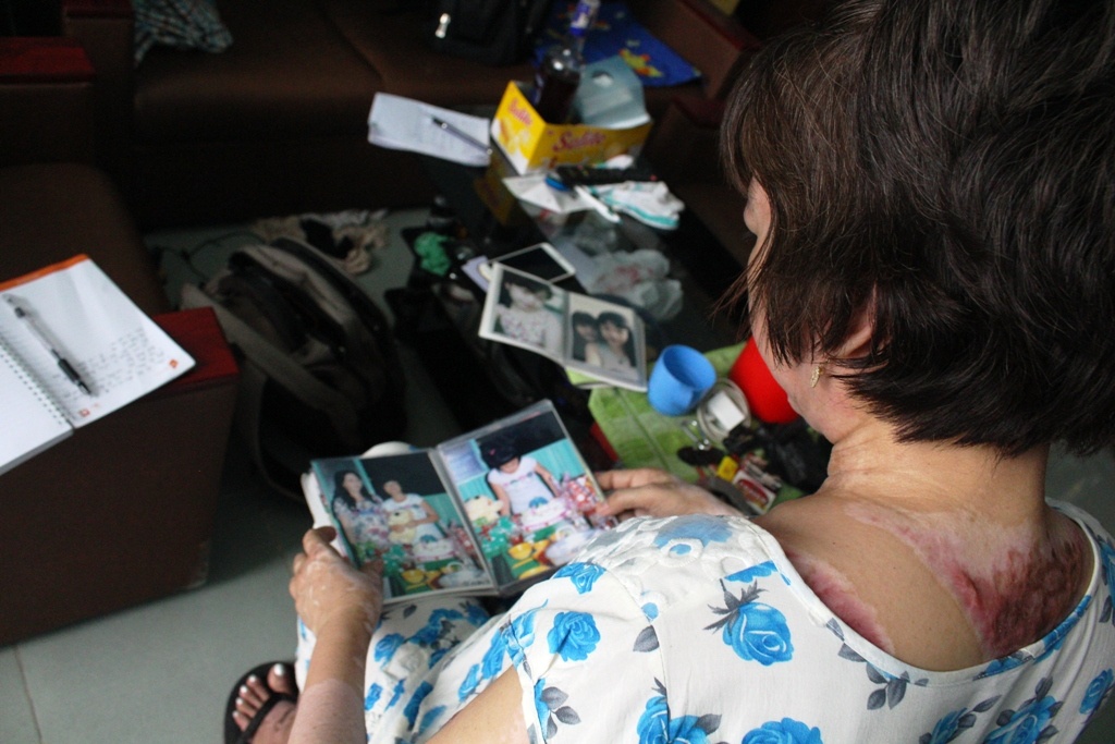 Noi dau cua nguoi me trong vu an tra thu tinh bang xang hinh anh