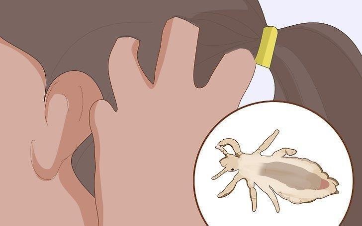 Nhung dieu kinh khung ve chay ran ma ban chua he biet hinh anh