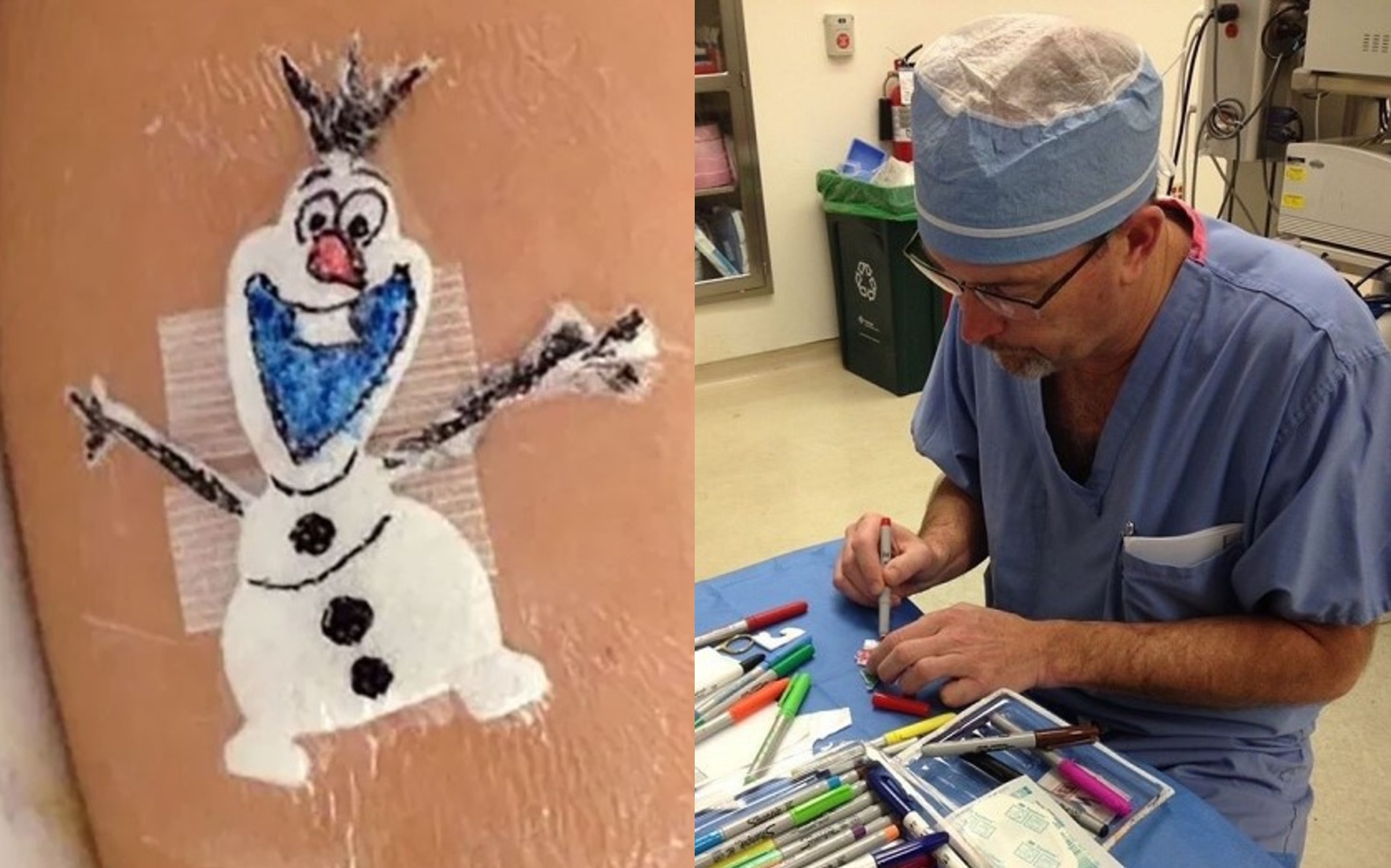 Bac si ve hinh che len vet seo phau thuat giup benh nhi bot so hinh anh