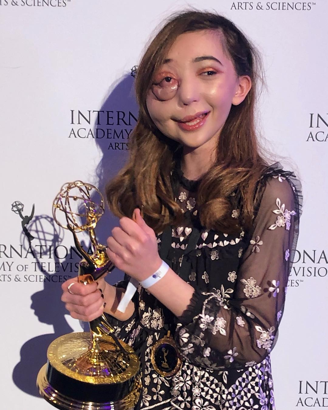 Cô gái quái vật trở thành niềm tự hào của nước Anh ảnh 8 Co gai quai vat tro thanh niem tu hao cua nuoc Anh anh 8