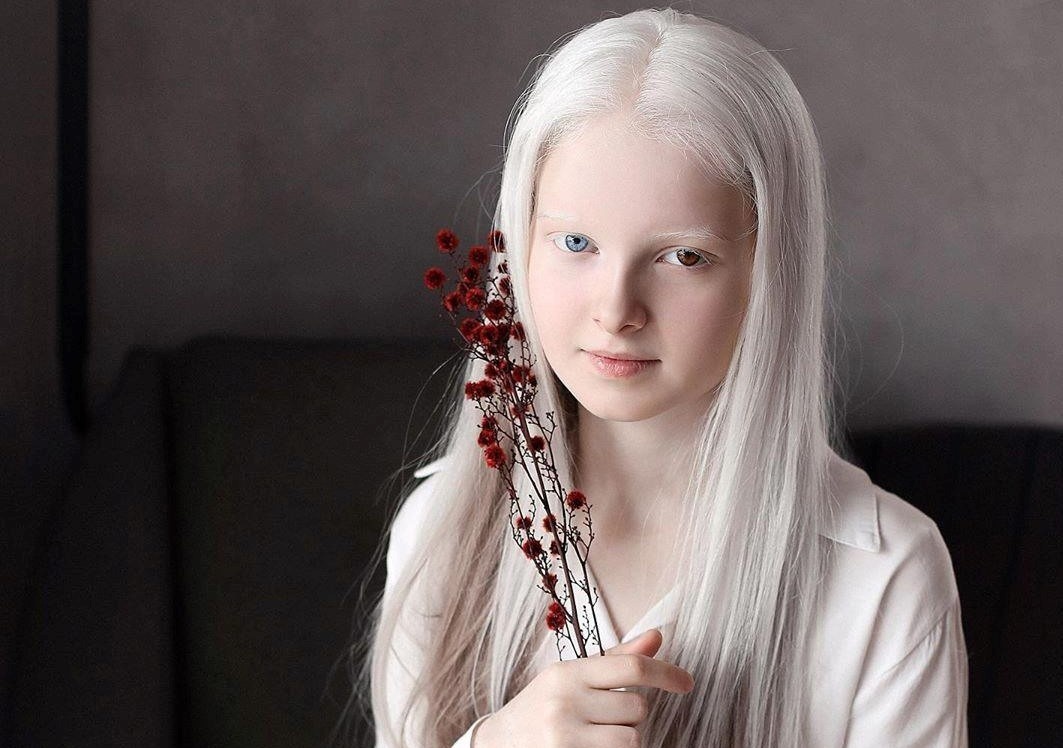 Ve dep khac la cua co gai bach tang co 2 mau mat hinh anh