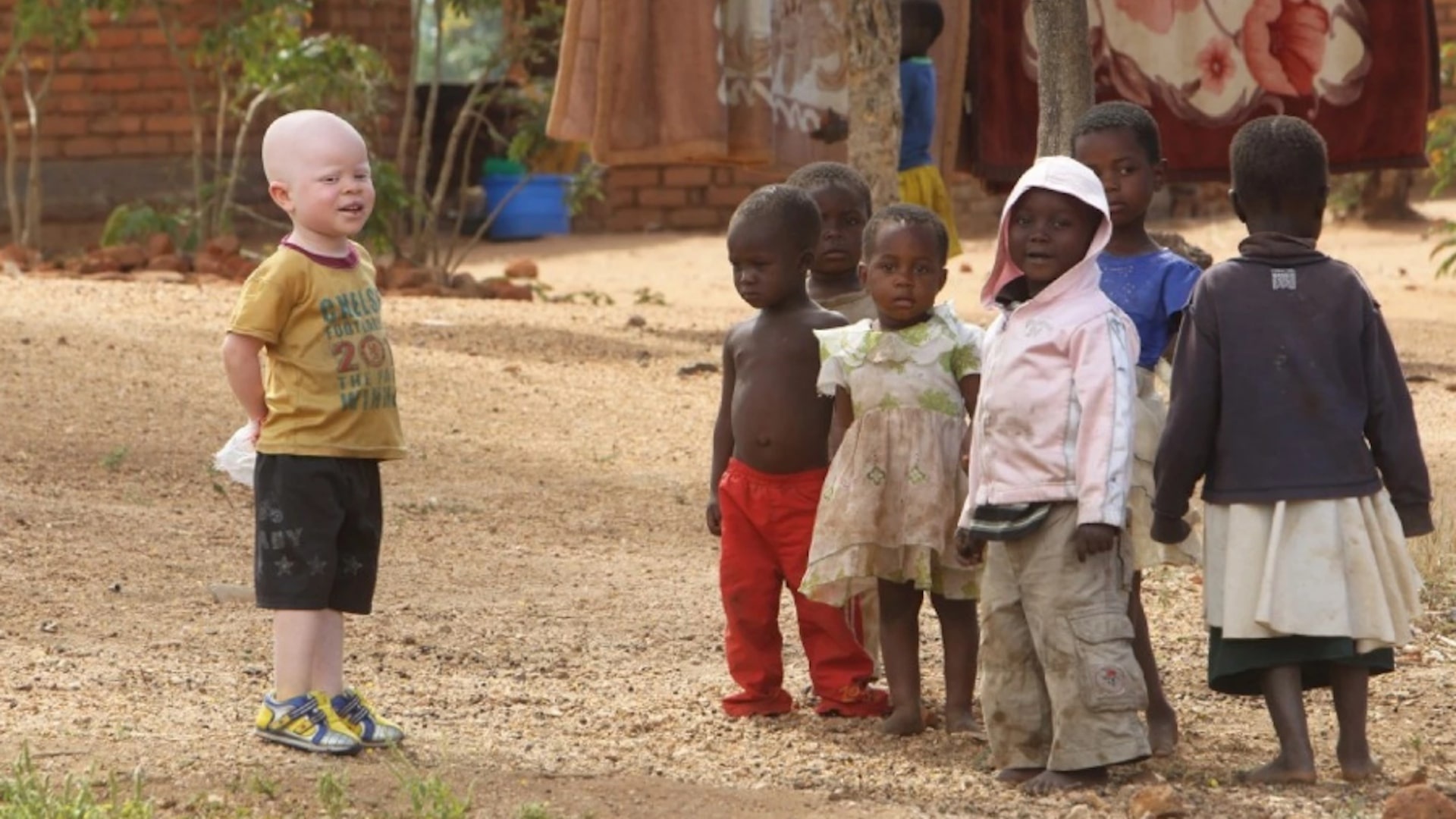 Nguoi bach tang o chau Phi bi nguyen rua la mam benh Covid-19 anh 2