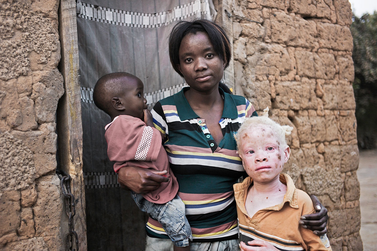 Nguoi bach tang o chau Phi bi nguyen rua la mam benh Covid-19 anh 4