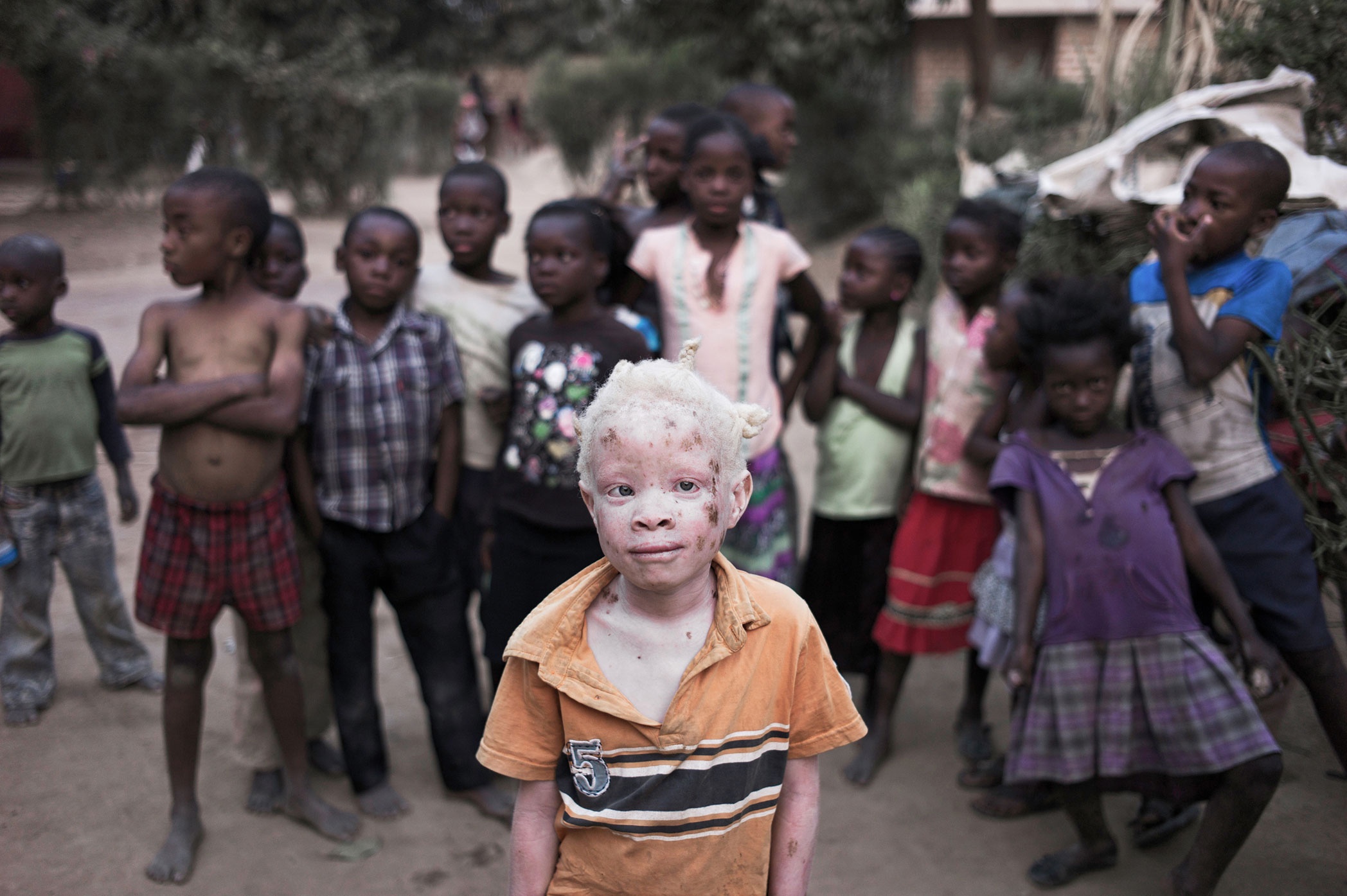 Nguoi bach tang o chau Phi bi nguyen rua la mam benh Covid-19 anh 3